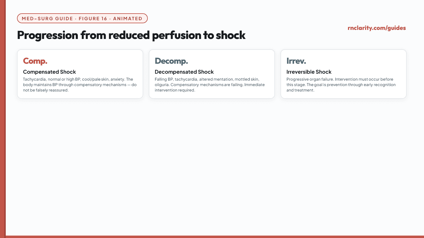 Animated diagram of progression from reduced perfusion to shock — compensated, decompensated and irreversible stages with key hemodynamic and clinical findings at each stage.